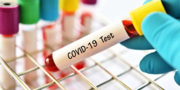 Coronavirus: Georgia Reports 538 New Cases, 41 Deaths