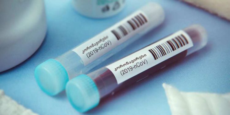 Georgia Reports 1881 New Cases of Coronavirus, 37 Deaths