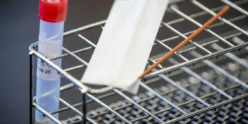 Coronavirus: Georgia Reports 1738 New Cases, 38 Deaths