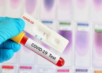 Coronavirus: Georgia Reports 594 New Cases, 3845 Tests Conducted