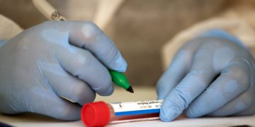 Coronavirus: Georgia Reports 1800 New Cases, 20 Deaths