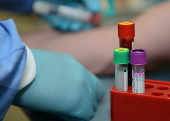 Coronavirus: Georgia Reports 551 New Cases, 7898 Tests Performed