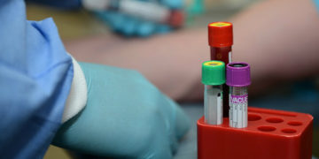 Coronavirus: Georgia Reports 551 New Cases, 7898 Tests Performed