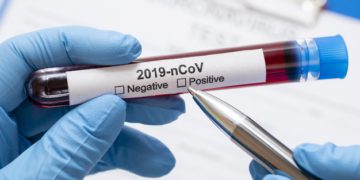 Coronavirus: Georgia Reports 337 New Cases, 10 Deaths