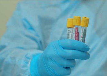 Coronavirus: Georgia Reports 557 New Cases, 10 Deaths