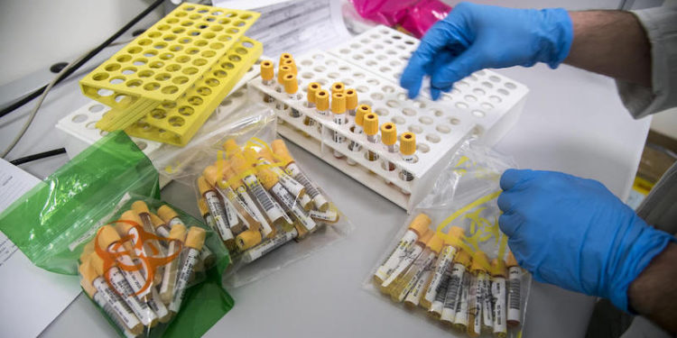 Coronavirus: Georgia Reports 147 New Cases, 15 Deaths