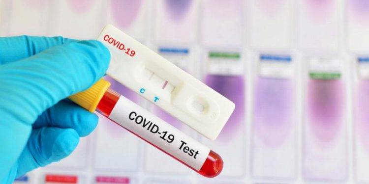 Coronavirus: Georgia Records 2171 New Cases, Positivity Rate almost 8%