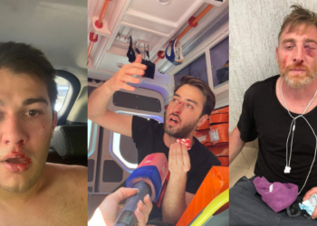 47 Media Employees Injured Following Violence by Tbilisi Pride Opponents