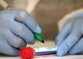 Georgia Reports 4,827 New Cases of Coronavirus, 34 Deaths