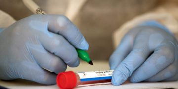 Georgia Reports 4,827 New Cases of Coronavirus, 34 Deaths