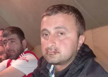 A hunger-striking miner in Chiatura sews his mouth shut in protest