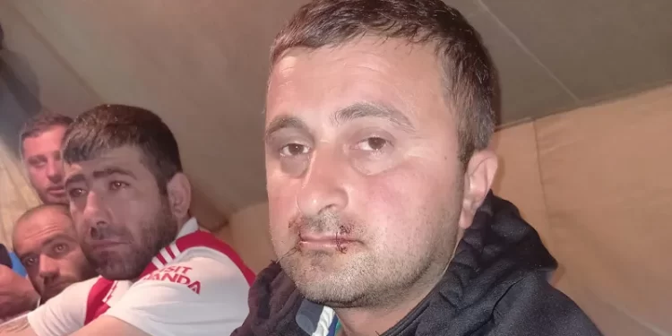 A hunger-striking miner in Chiatura sews his mouth shut in protest