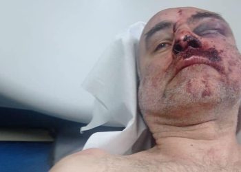 Davit Katsarava, a member of the Anti-Occupation Movement, arrested and beaten at rally