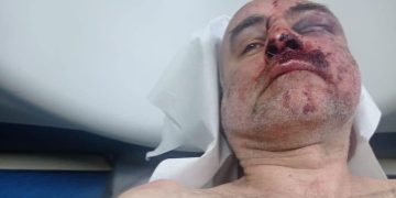 Davit Katsarava, a member of the Anti-Occupation Movement, arrested and beaten at rally