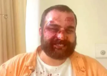 NGOs on attacks: Gov’t started to show what kind of country they intend to make from Georgia