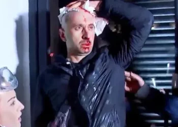 Journalist Guram Rogava suffers facial bone and neck fractures