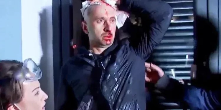 Journalist Guram Rogava suffers facial bone and neck fractures