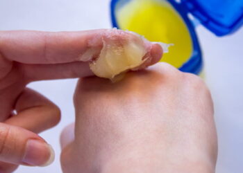 Georgia’s vaseline imports decline in 2024