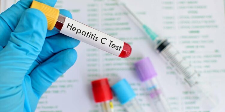 Health Ministry reviews Hepatitis programs and progress