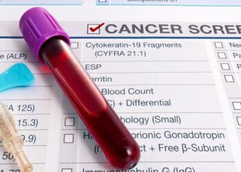 Tbilisi to launch free lung cancer screening programme from May 1