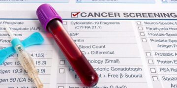 Tbilisi to launch free lung cancer screening programme from May 1