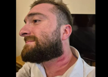 Court grants GEL 5,000 bail to man arrested over Telavi hotel incident