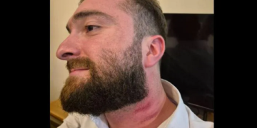 Court grants GEL 5,000 bail to man arrested over Telavi hotel incident