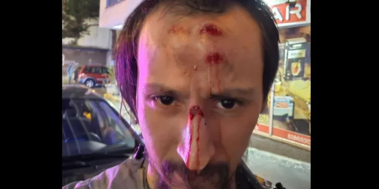 Police arrest two more over assault on Glovo courier in Tbilisi